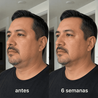 ELÁRA™ Banda Moldeadora de Colágeno