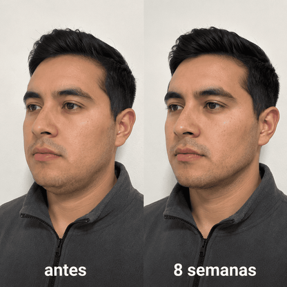 ELÁRA™ Banda Moldeadora de Colágeno