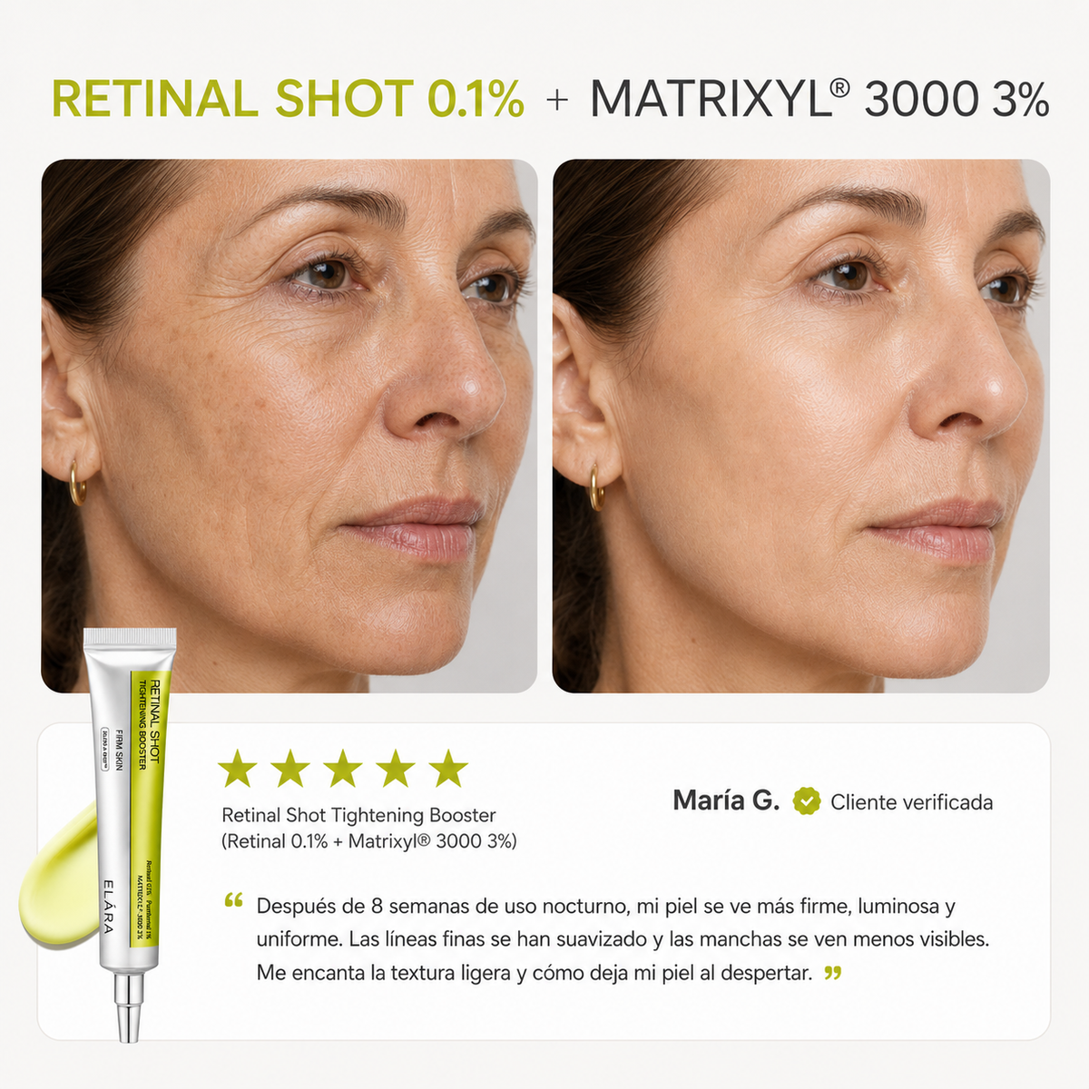 ELÁRA™ Retinal Glow Shot